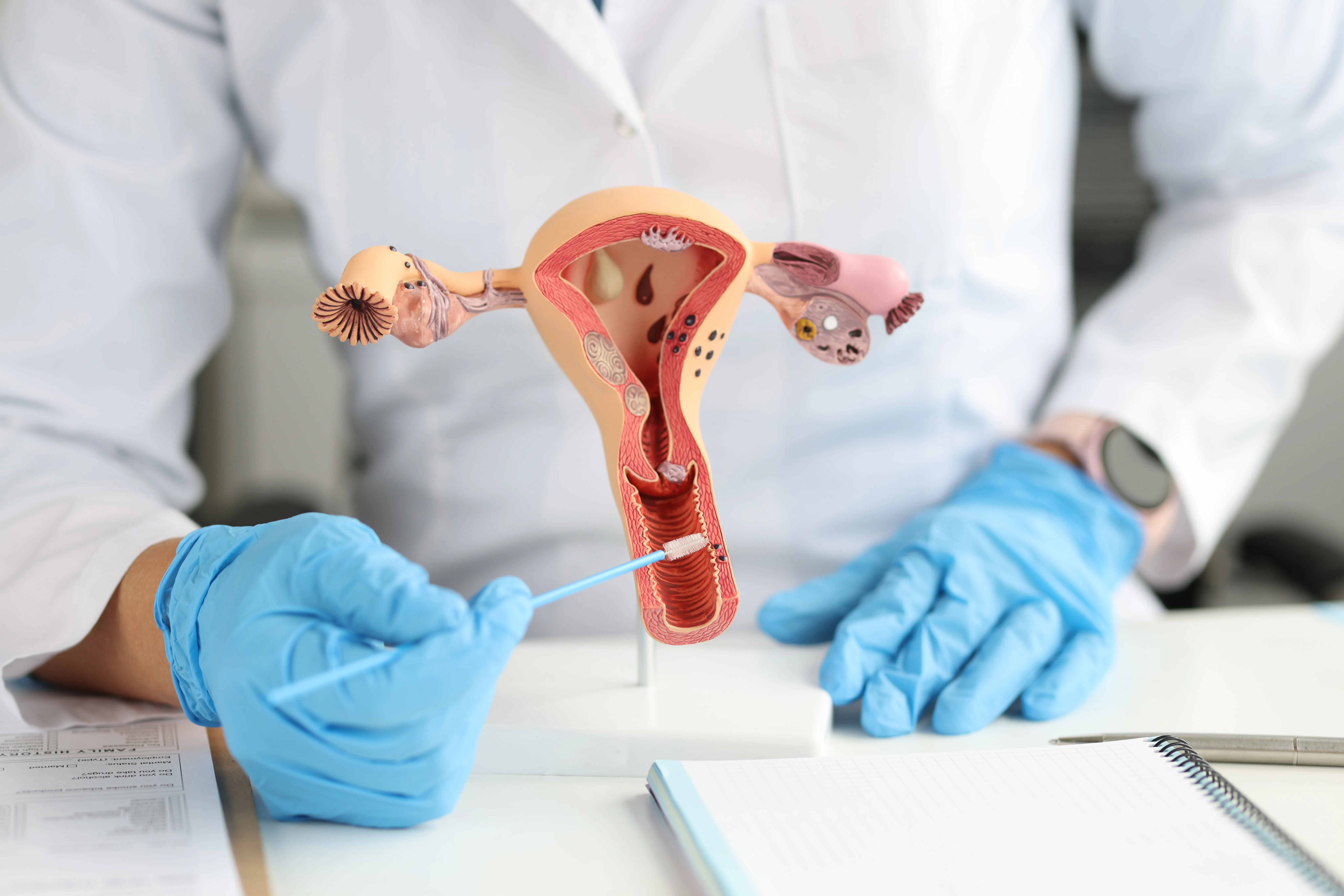 Cervical biopsy
