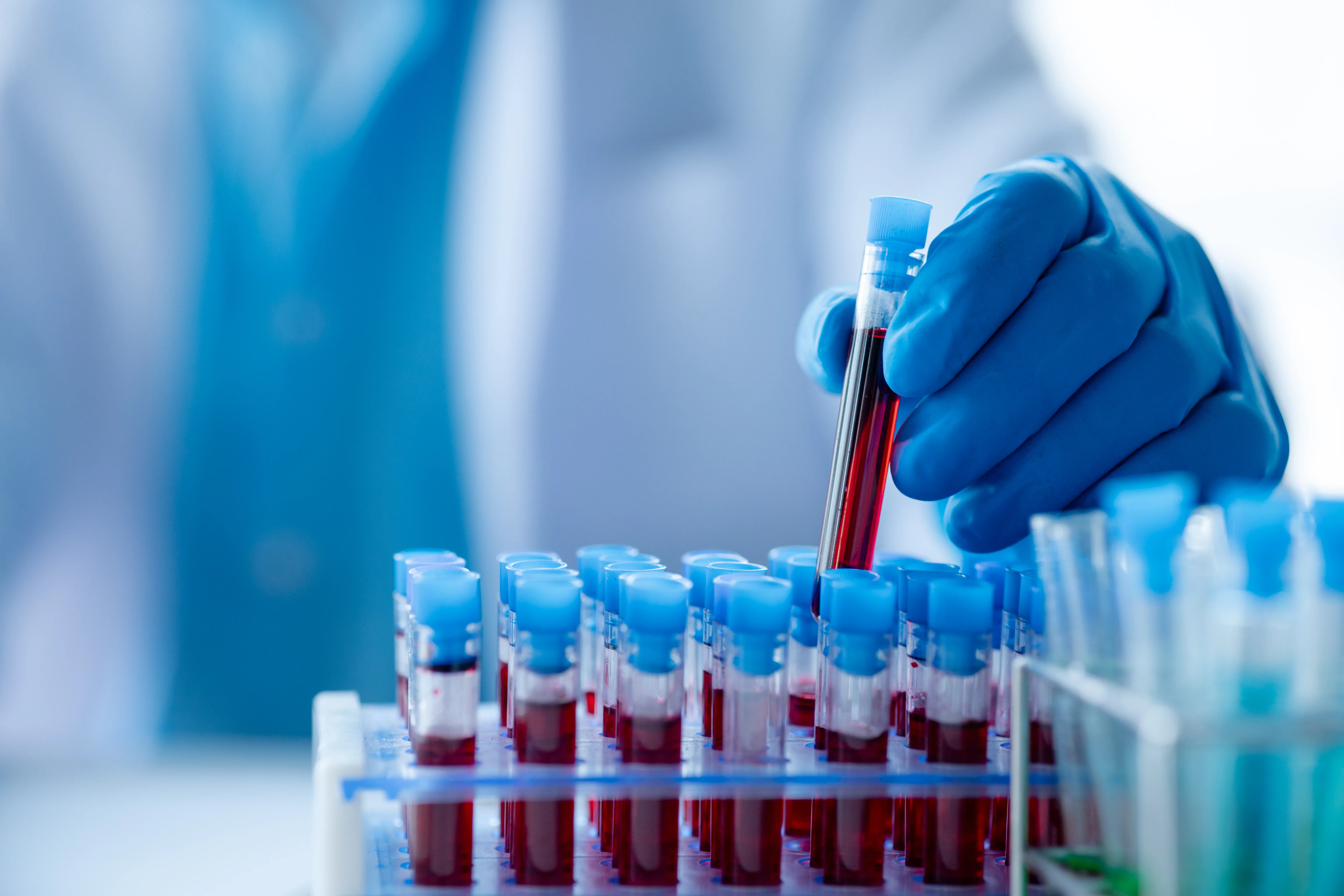 Hormonal blood tests