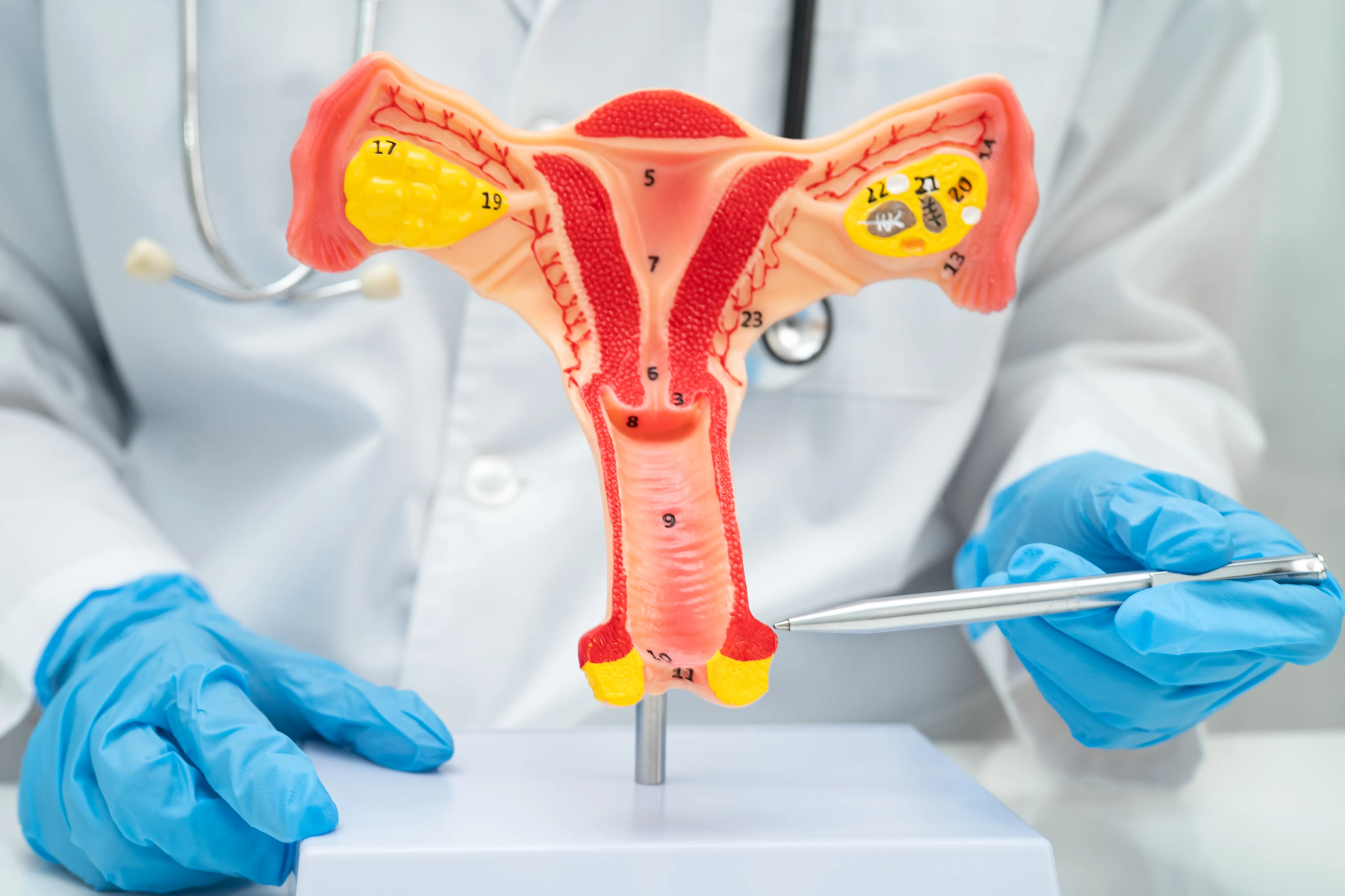 Myomectomy