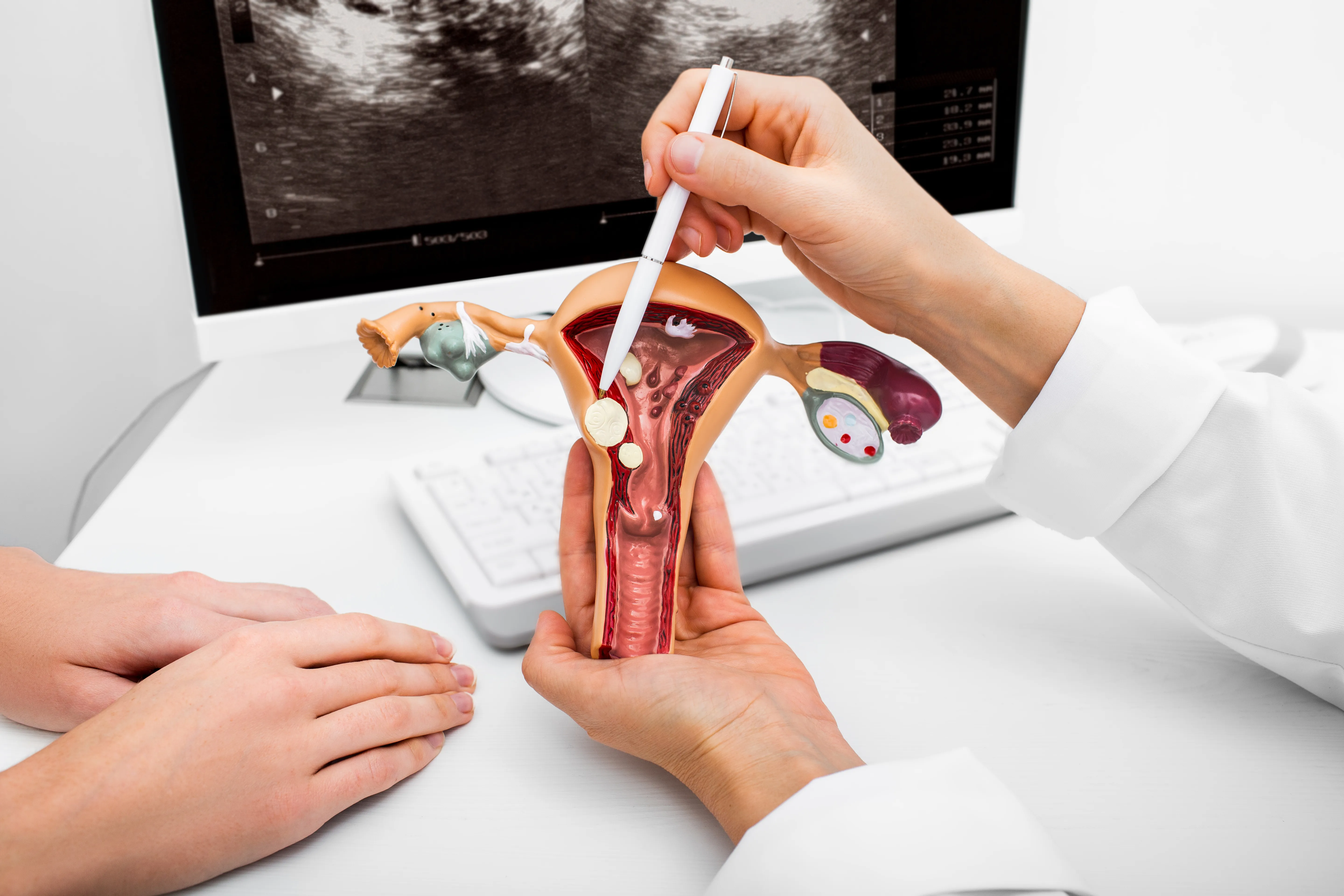 Polyp removal & MyoSure