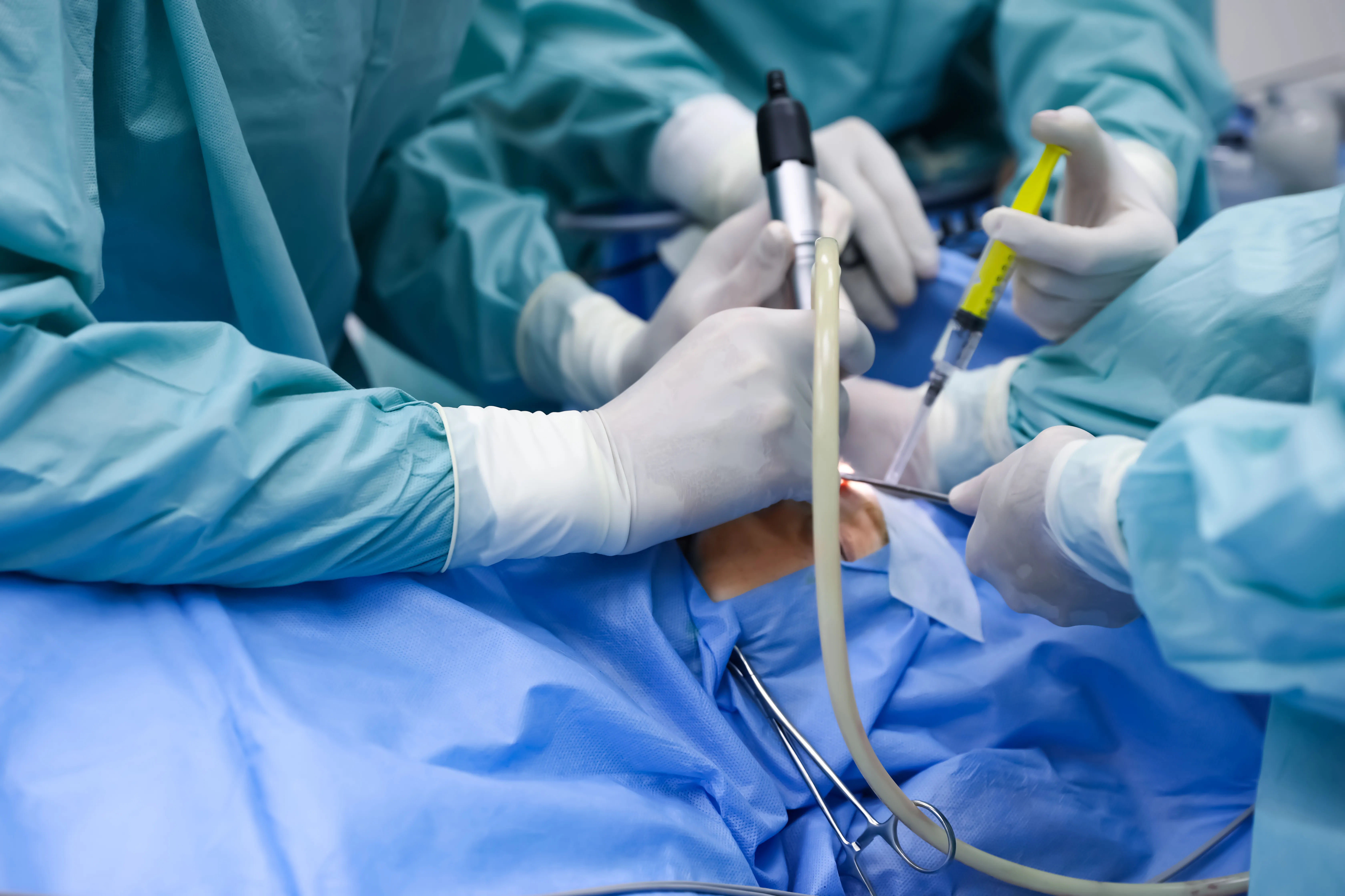 Suction curettage (ERPC)