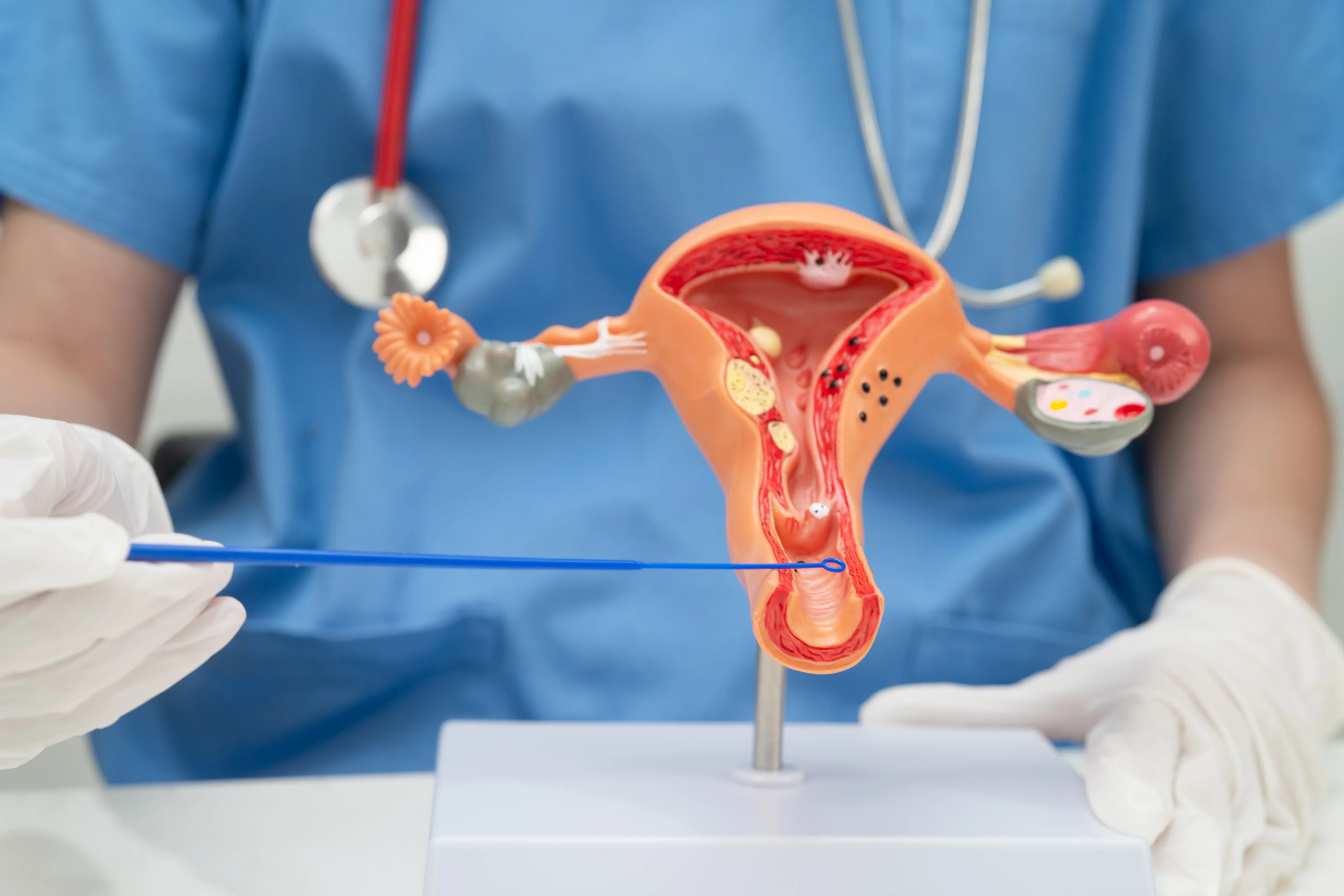 Vulval biopsy